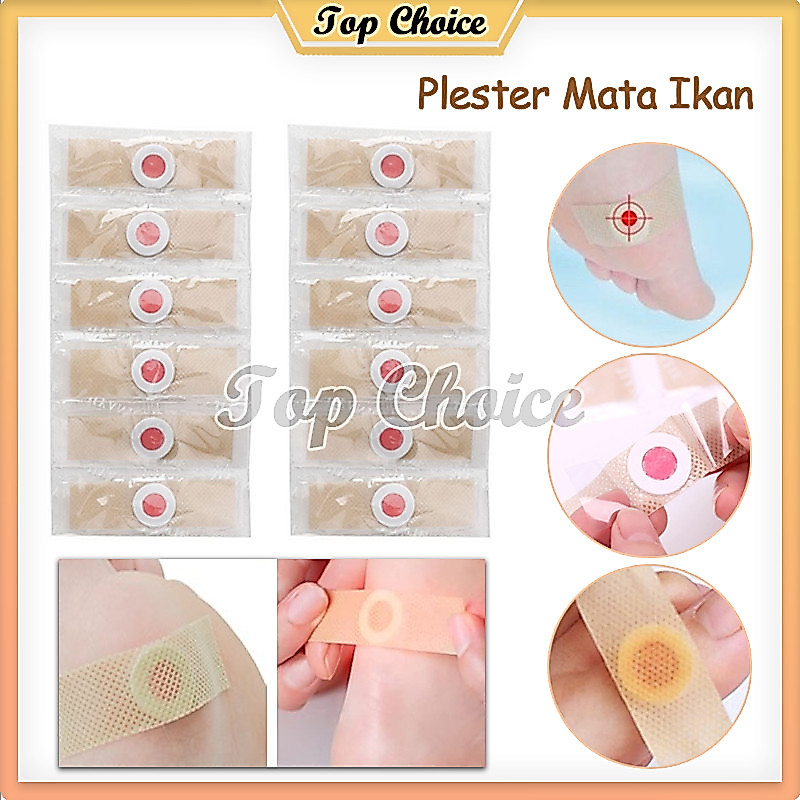 Plester Mata Ikan 6PCS / Plester Kutil / Plester Obat Mata Ikan