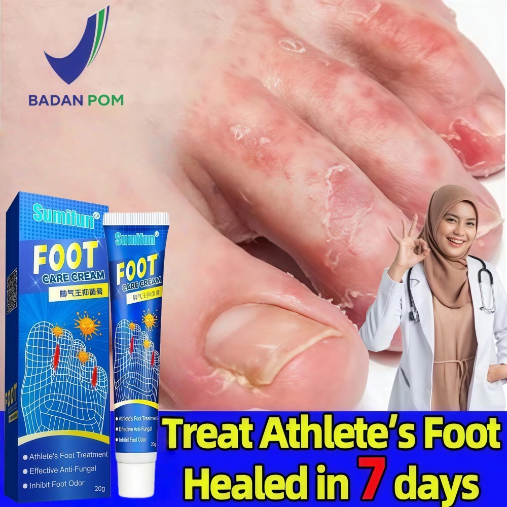 Obat Kaki Rayapan Dan Bau Obat Gatal Krim Pengelupas Kulit Mati Kaki Pembersih Kulit Mati Tumitku Ob