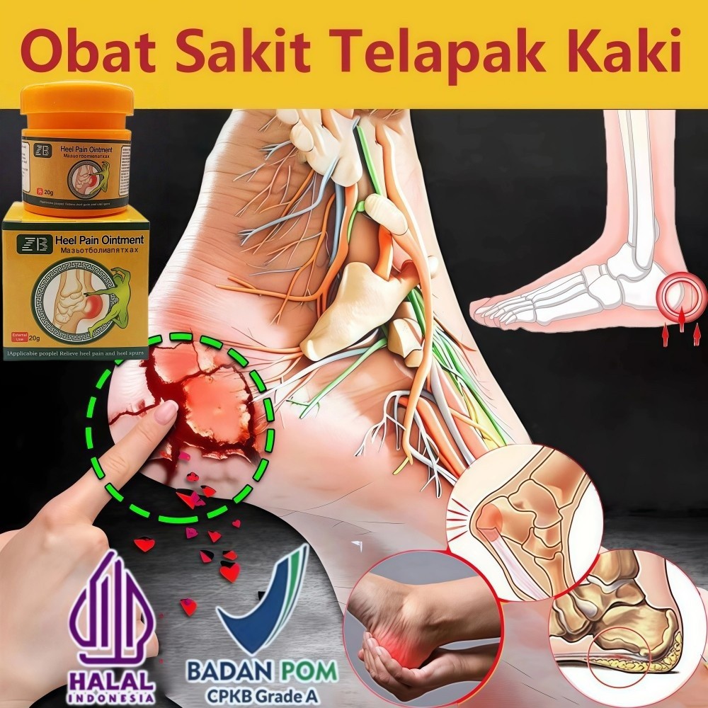 obat sakit tumit Plantar fasciitis terapi salep pereda nyeri Pengobatan sakit tumit kaki kaki kesemu