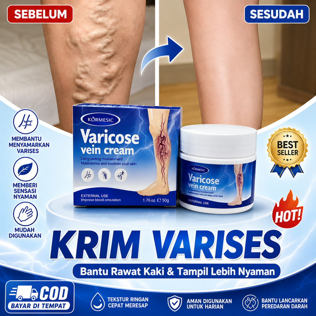Obat Varises, Penghilang Varises, Varises di Kaki Tangan Betis Perut Wajah dan Testis, Urat Menonjol