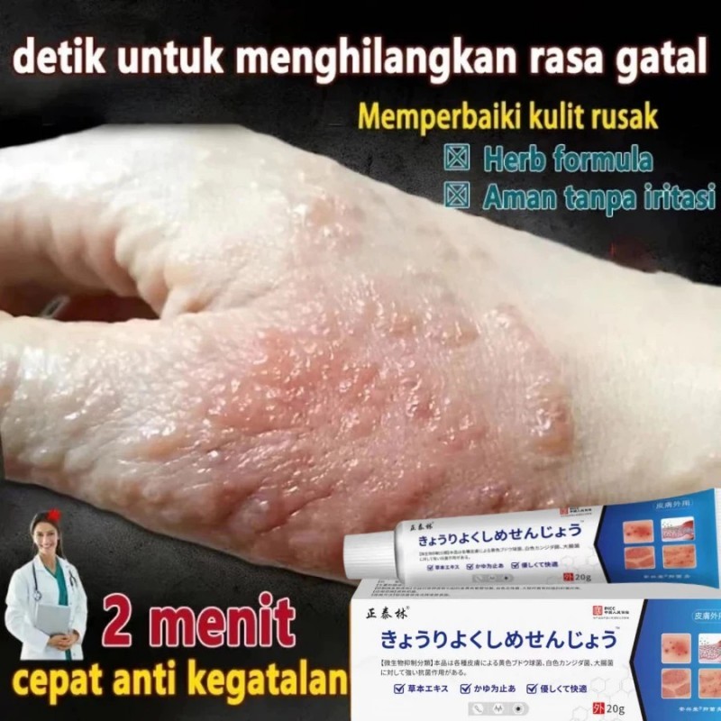 7 DAYS Psoriasis Ointment Eczema Cream Relief Dermatiti/Itchy Allergy Cream Eczema Cream For Treatin