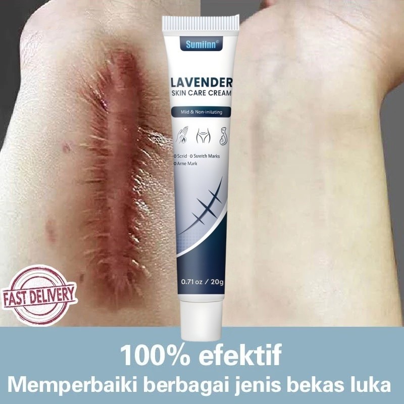 Krim Cream Salep penghilang luka bekas Menghilangkan stretch mark Penghilang bekas luka yang ampuh M
