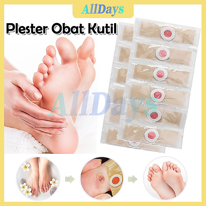Plester Mata Ikan Penghilang Kutil /Plester Kutil Mata Ikan Kapalan