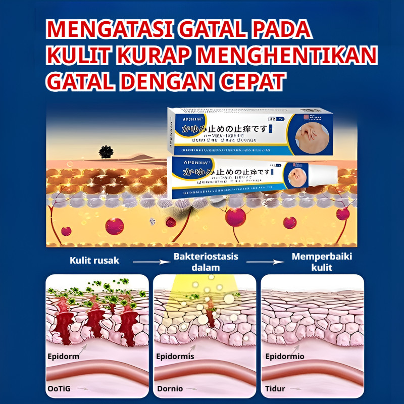 Kirim Dalam 24 Jam/ [Redakan Gatal Cepat & Efektif] Krim Antijamur Kulit/Gatal Kulit/Infeksi Jamur/O
