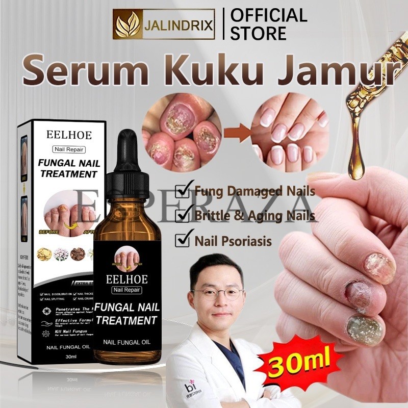 Jalindrix Obat jamur kuku serum kuku vitamin serum kuku jamur dan rusak obt kuku jamur dan rusak ori