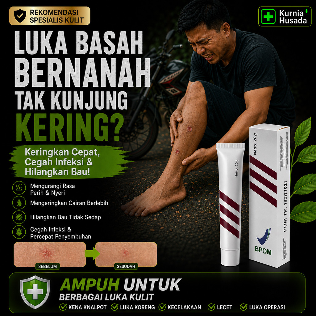 Salep Obat Luka Terbuka Basah Bernanah Kulit Lecet Luka Pasca Operasi
