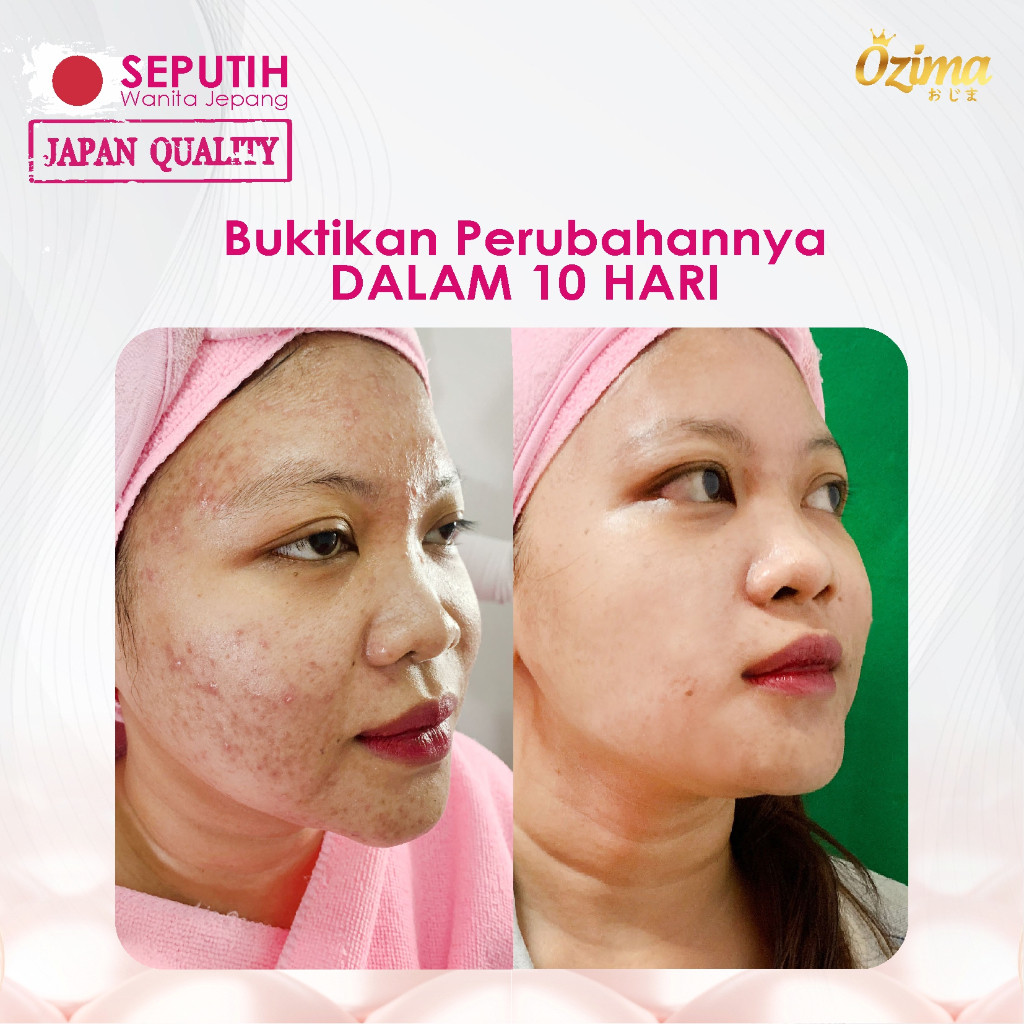 

JAMIN MURAH !!!Ozima gluta collagen drink ikan salmon | collagen tripeptide | Kolagen drink | collagen dna salmon(BISA LANGSUNG ORDER)