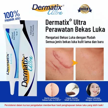 [100% ORI] Dermatix Ultra 15Gr Cream Krim Penghilang Bekas Luka 15 Gram Strechmark Strech Mark Jahit