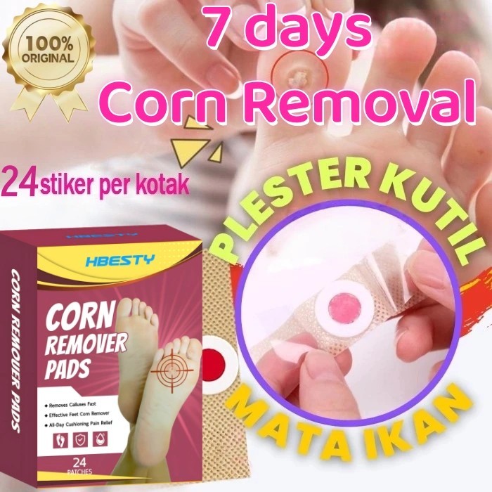 Plester Mata Ikan Paling Ampuh 24pcs/box Plester Mata Ikan Plester Obat Kutil Foot Corn Removal Penu