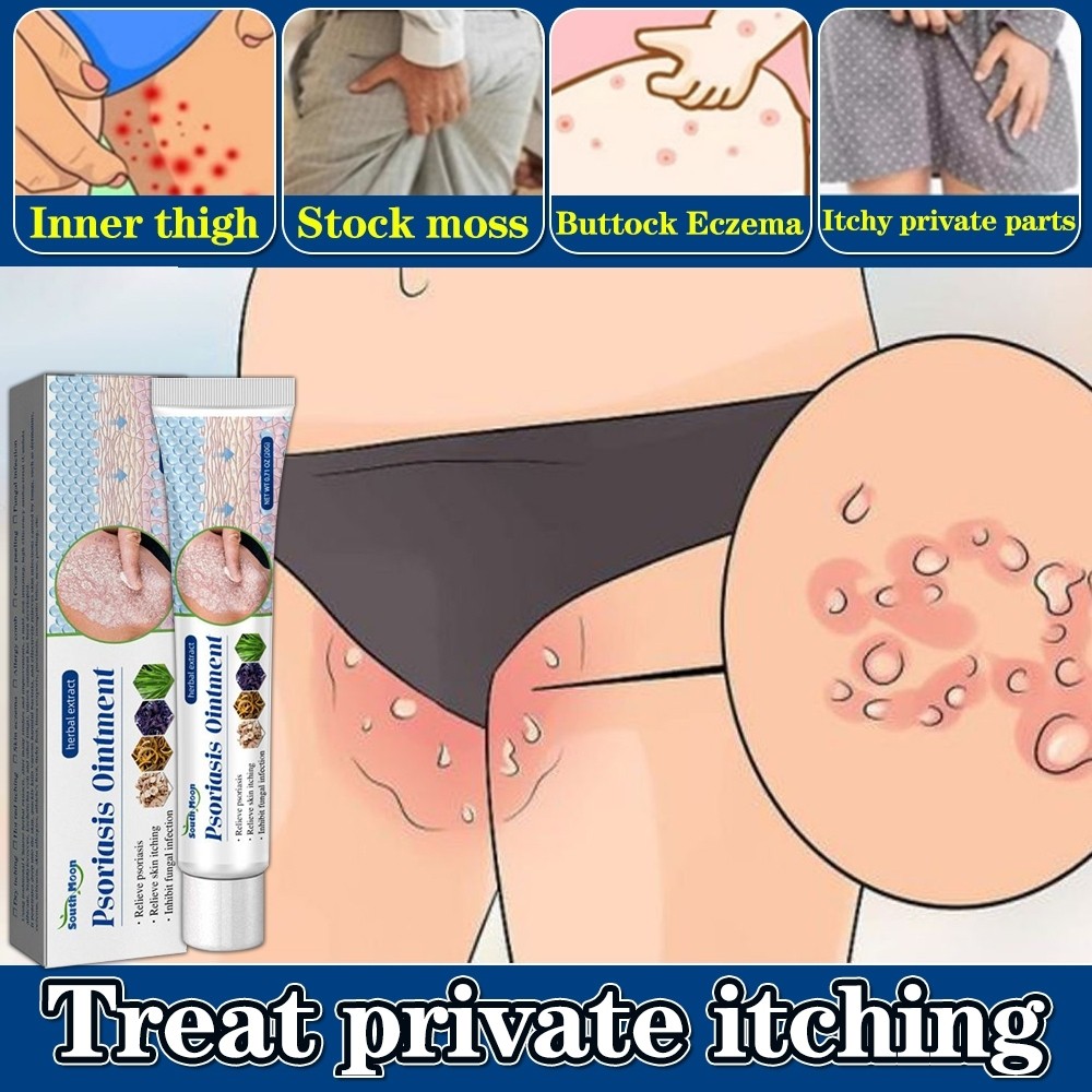 salep gatal paling ampuh salep gatal salep eksim salep gatal selangkangan obat gatal selangkangan ob
