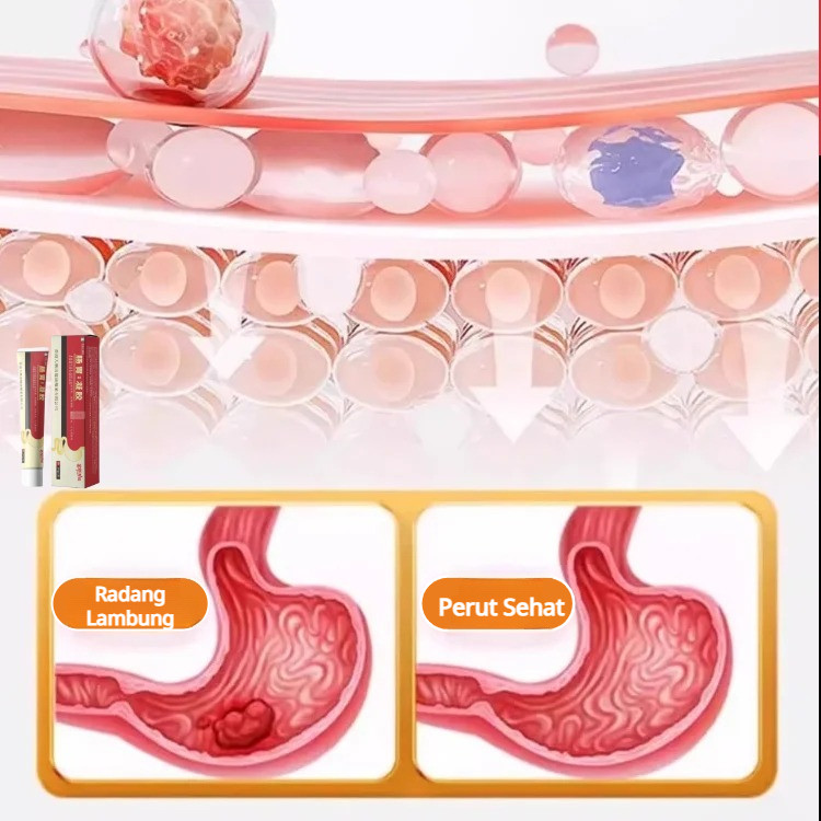 Salep antibakteri untuk sakit perut dan perut kembung gel pendukung111111111111111111111111111111111