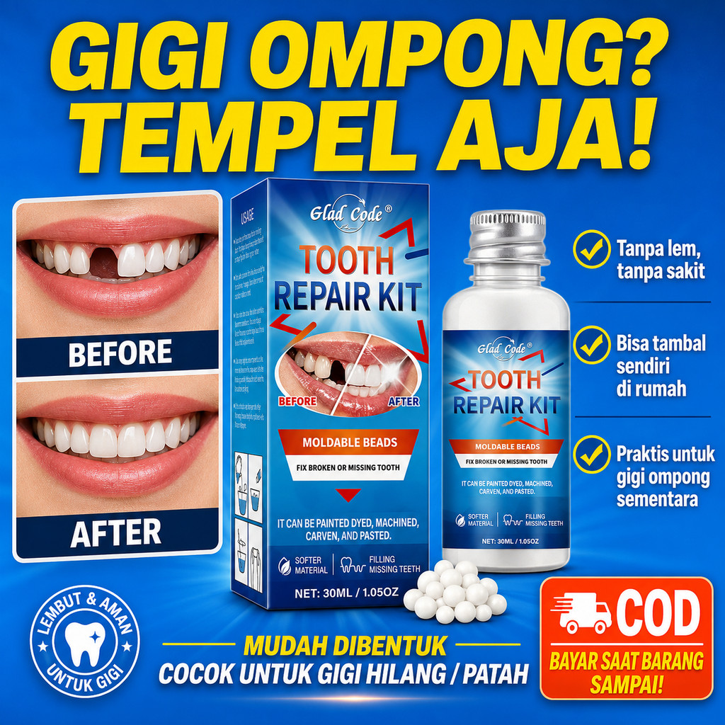 GIGI PALSU 30g PENAMBAL GIGI PATAH RENGGANG TEMPORARY TOOTH TEMPTOOTH GINGSUL PATAH KELINCI / Snap O
