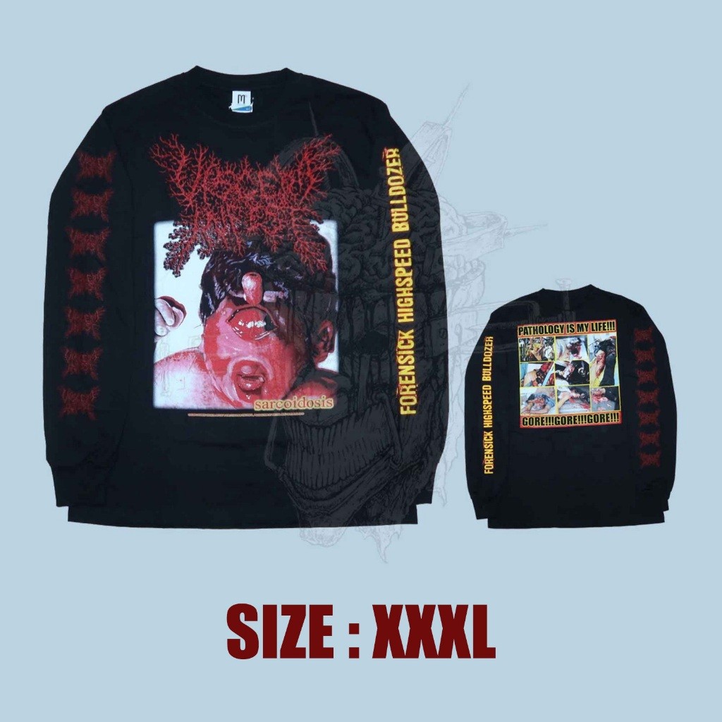 LS - VISCERA INFEST - Sarcoidosis