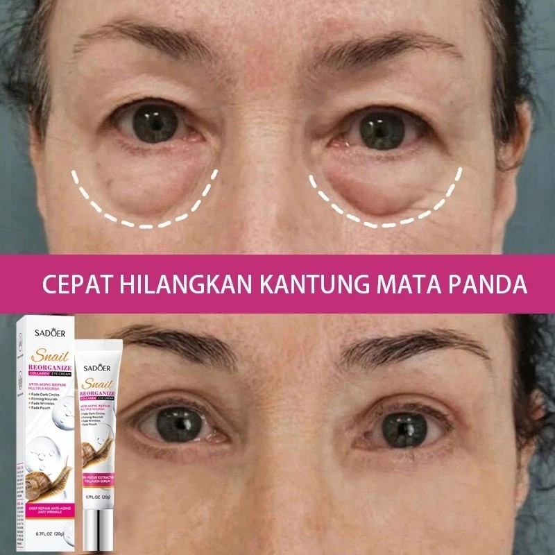 SADOER Krim Mata Hilangkan Mata Panda & Kantung Mata, Samarkan Keriput Kelopak Mata Serum Perawatan 