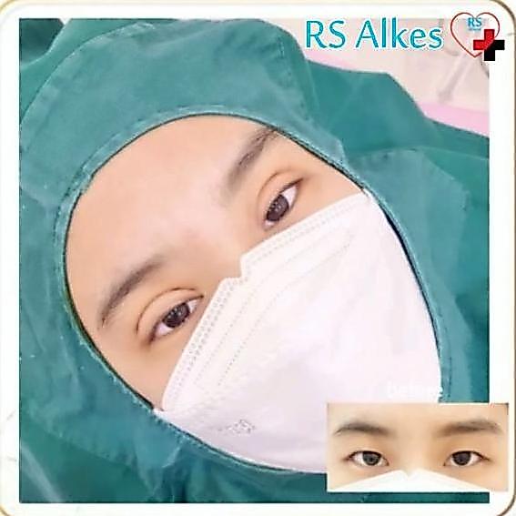 [ New ] Duk Lubang Operasi Wajah 60x60 Duk Lubang 60 x 60 Duk Operasi