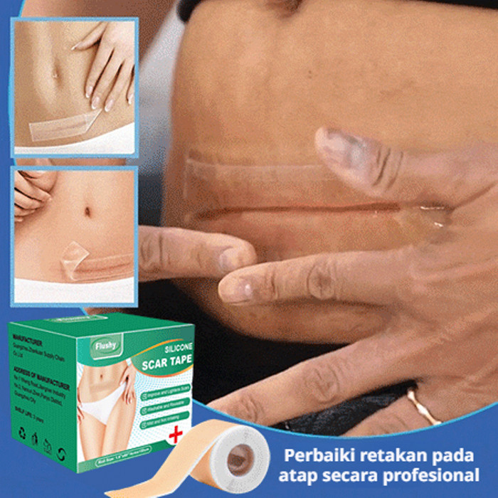 Plester Bekas Luka Perekat Tahan Air Dan Bernapas|Plester Perawatan Bekas Luka Operasi Caesar 5M|Ple