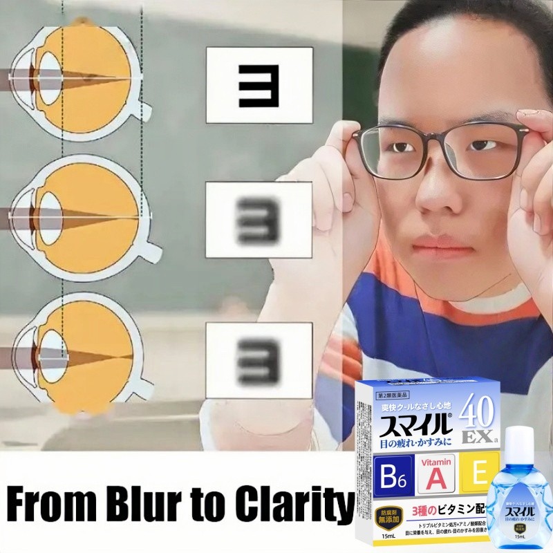 40EX a Tetes Mata Perawatan Mata (Buatan Jepang) Obat Tetes mata katarak 15ml buram untuk dewasa mat