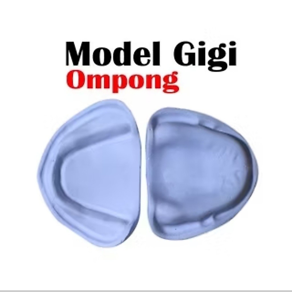 Model Gigi Ompong