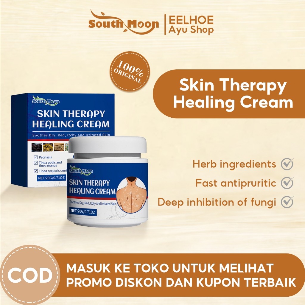 South Moon Skin Healing Cream Salep Psoriasis Krim Salep Gatal Anti Itchy Salep Psoriasis Krim Salep