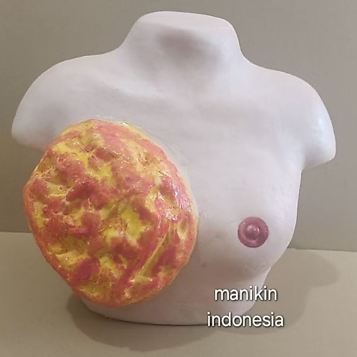 MANIKIN -TUMOR PAYUDARA / PHANTOM MANIKIN TUMOR PAYUDARA / ALAT PERAGA KANKER