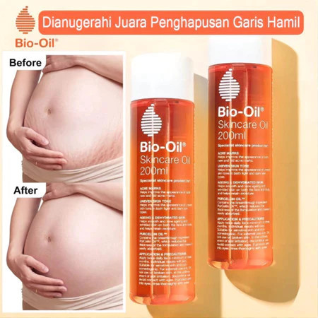 [ 100% ORI ] Bio Oil 200ml Bio Oil Penghilang Bekas Luka - Bio Oil Stretch Mark/BIO OIL Skincare/Bio