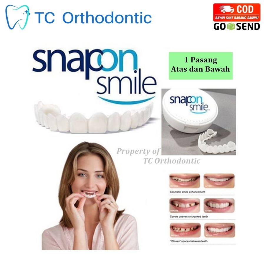 inputmode Snap On Smile Gigi Palsu Atas Bawah Pria Wanita Snap on Smile Veneers Gigi Perfect Smile G