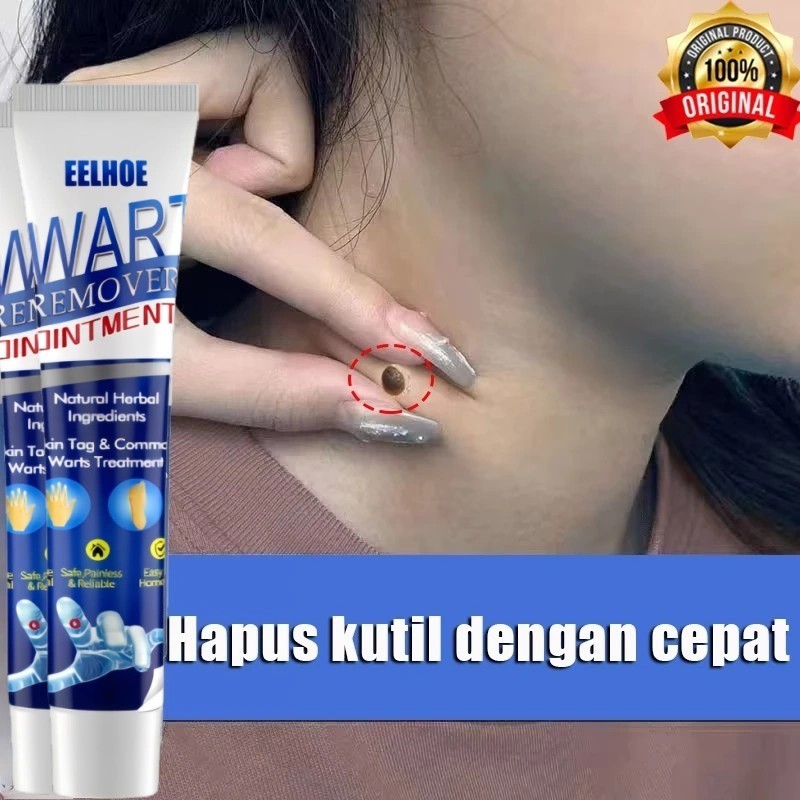WART REMOVER CREAM PENGHILANG KUTIL DAN TAHI LALAT