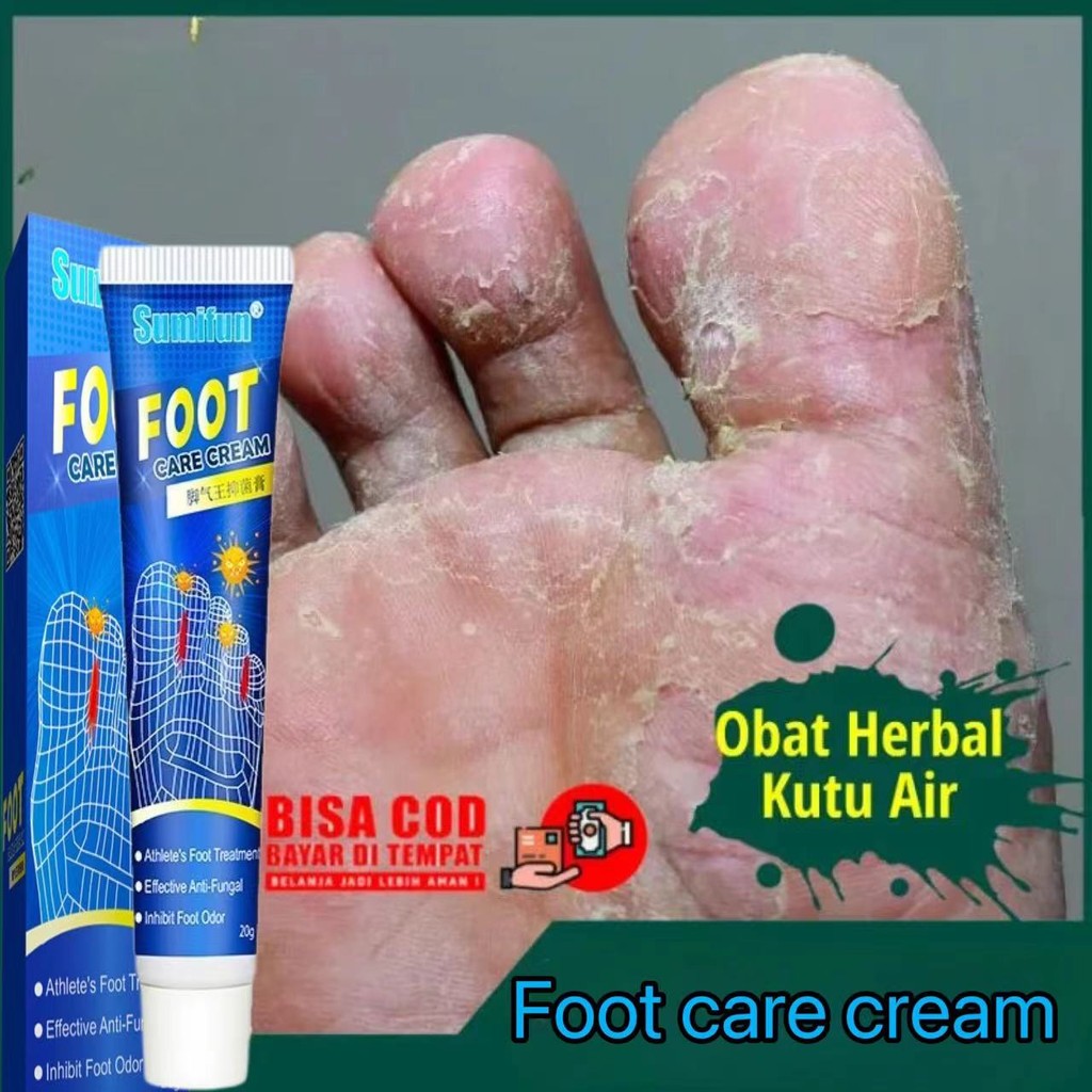 Obat Kaki Rayapan Dan Bau Salep Obat Gatal Krim Pengelupas Kulit Mati Kaki Pembersih Kulit Mati Tumi