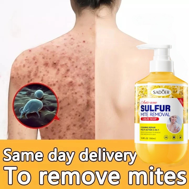 Eczema sabun mandi cair body wash Pengobatan Eksim eksim kering Kurap gatal kulit jamur kulit eksim 