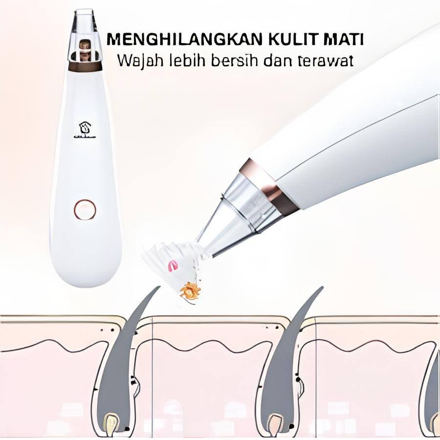 (DAS) Alat penyedot komedo / Vacuum Alat penyedot komedo / Alat pembersih komedo / Vakum Penyedot Ko