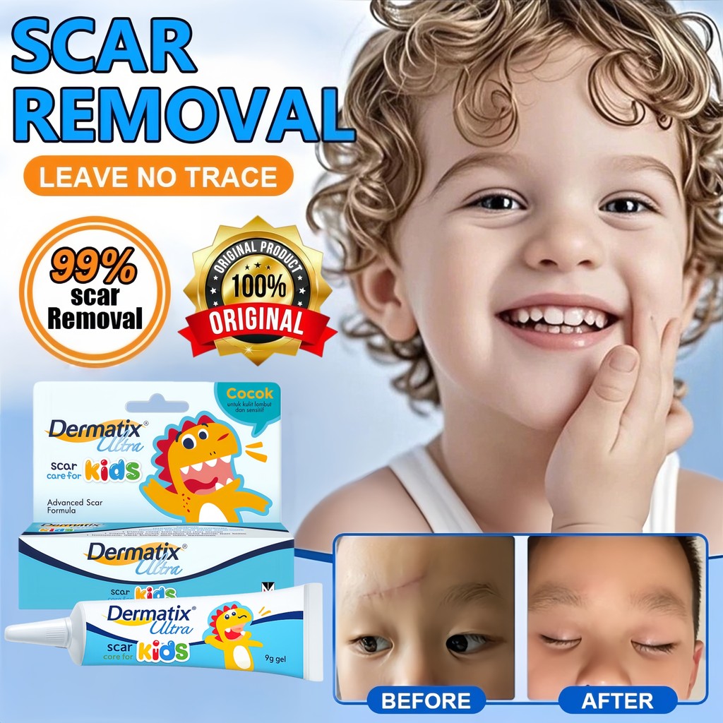 Dermatix Ultra Kids 9g Asli Ampuh Hilangkan Bekas Luka Bakar Operasi Noda Hitam Stretch Mark Aman Un