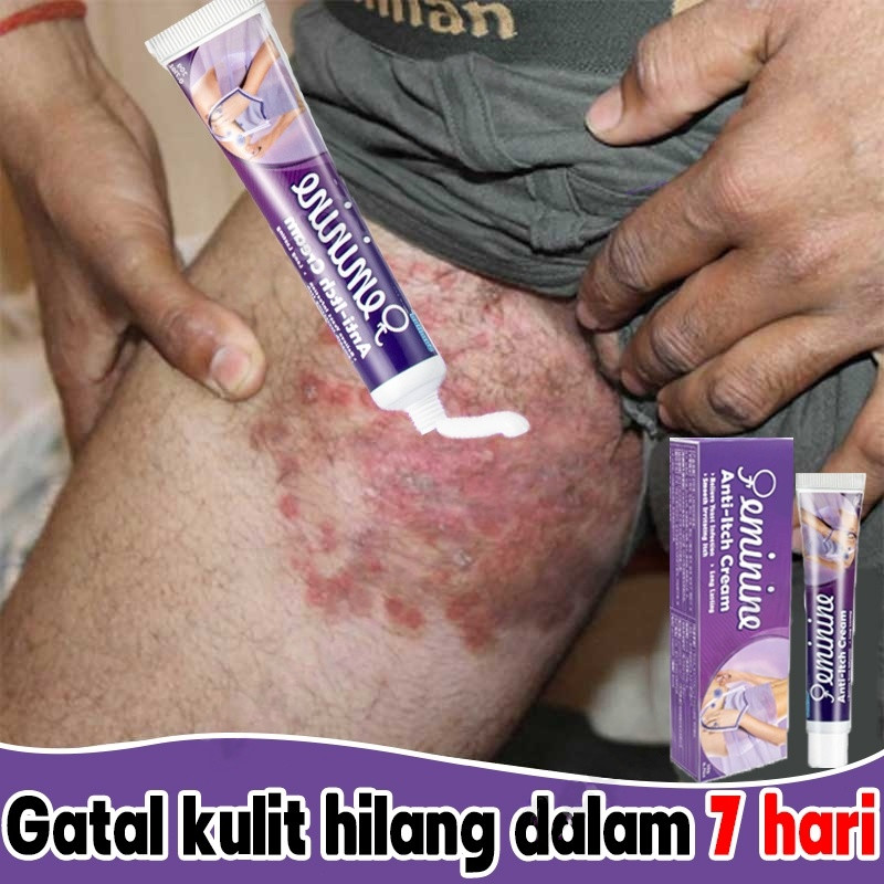 100%Ori Salep gatal paling ampuh obat gatal selangkangan obat gatal paling ampuh 20g Salep gatal sel