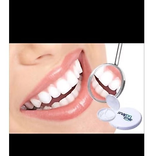 snap on smile