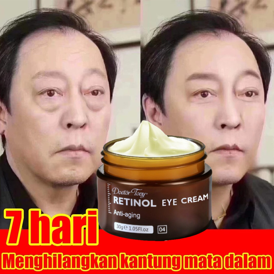【100% Asli】Krim Mata Anti Keriput Kantung mata Perawatan Kulit Anti-krim kantung mata ampuh-menghila