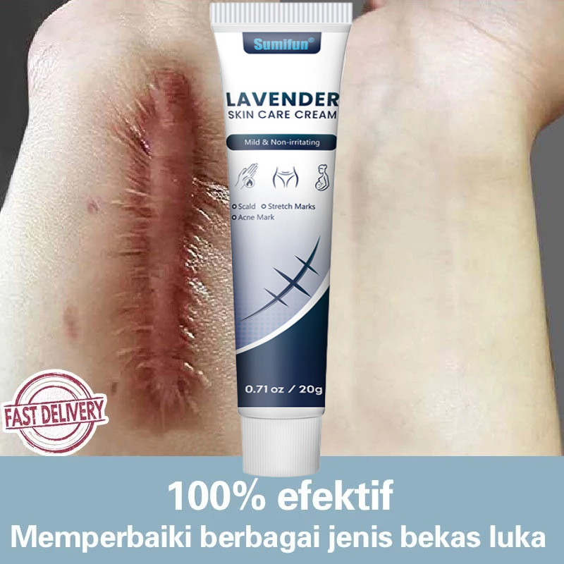 Salep penghilang bekas luka Penghilang bekas luka hitam koreng Obat penghilang bekas luka Menghilang