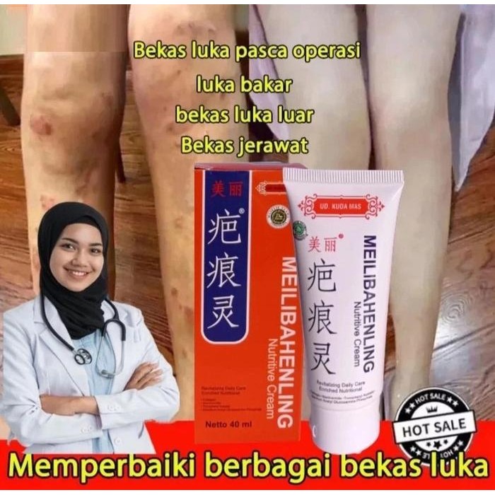 PROMO  MEILIBAHENLING CREAM SALEP PENGHILANG BEKAS LUKA KULIT ANAK DEWASA BPOM MENGHILANGKAN BEKAS L