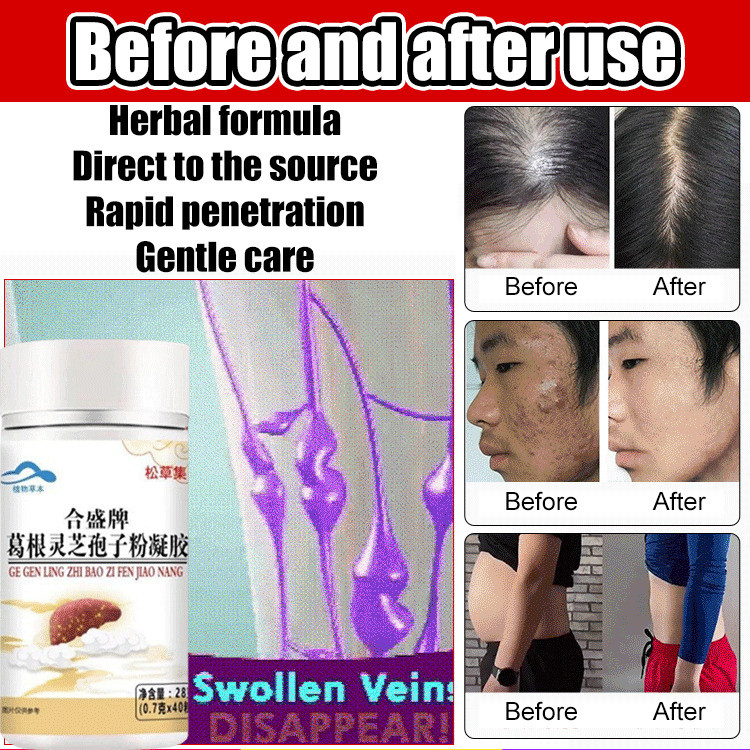 Kapsul Bubuk Spora Pueraria Mirifica Merek Hesheng