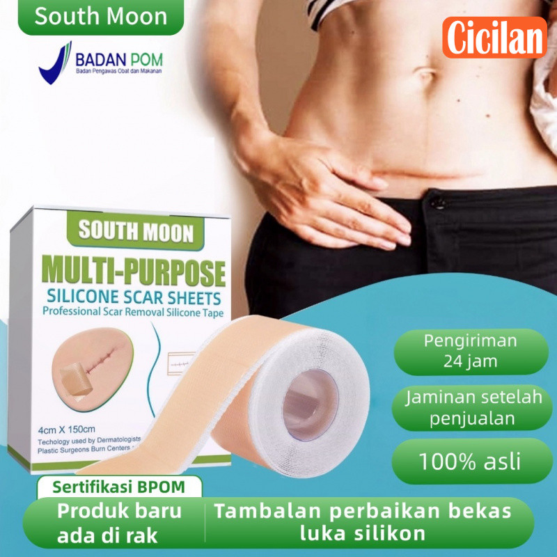 South Moon Multi-Purpose Silicone Scar Sheets 1pcs  Silicone Keloid 1Roll Keloplast Silicone Keloid 
