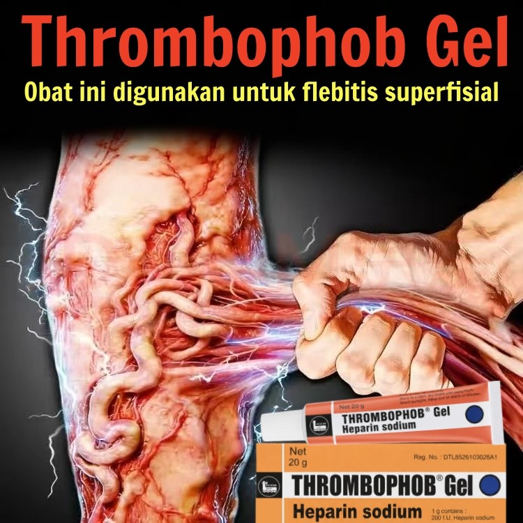 Obat varises salep varises cream varises paling ampuh original obat varises paling ampuh salep varis
