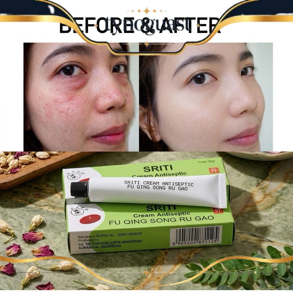 READY PROMO Sriti Antiseptic 10gr Salep Jerawat Flek Hitam Iritasi Aman SRITI Cream Antiseptic Origi