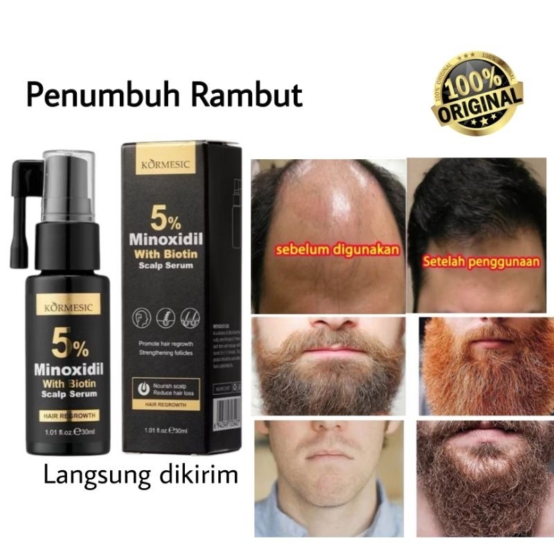 Penumbuh rambut biotin minoxidil brewok jenggot