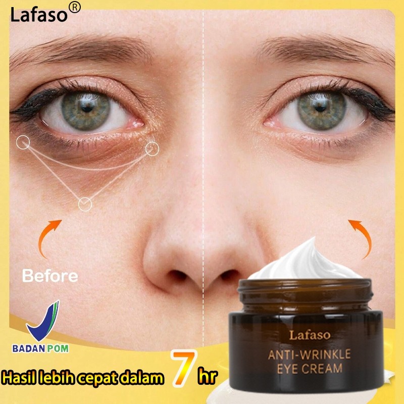 MMS - Eye Cream Krim Mata Anti-Aging Cream 30g Mata Panda dan Keriput Untuk Kerut Wajah Flek Hitam K