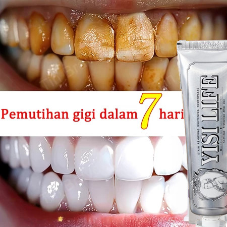 ADA YISILIFE marvis Whitening mint toothpaste odol gigi marvis pasta gigi odol pemutih gigi karang g