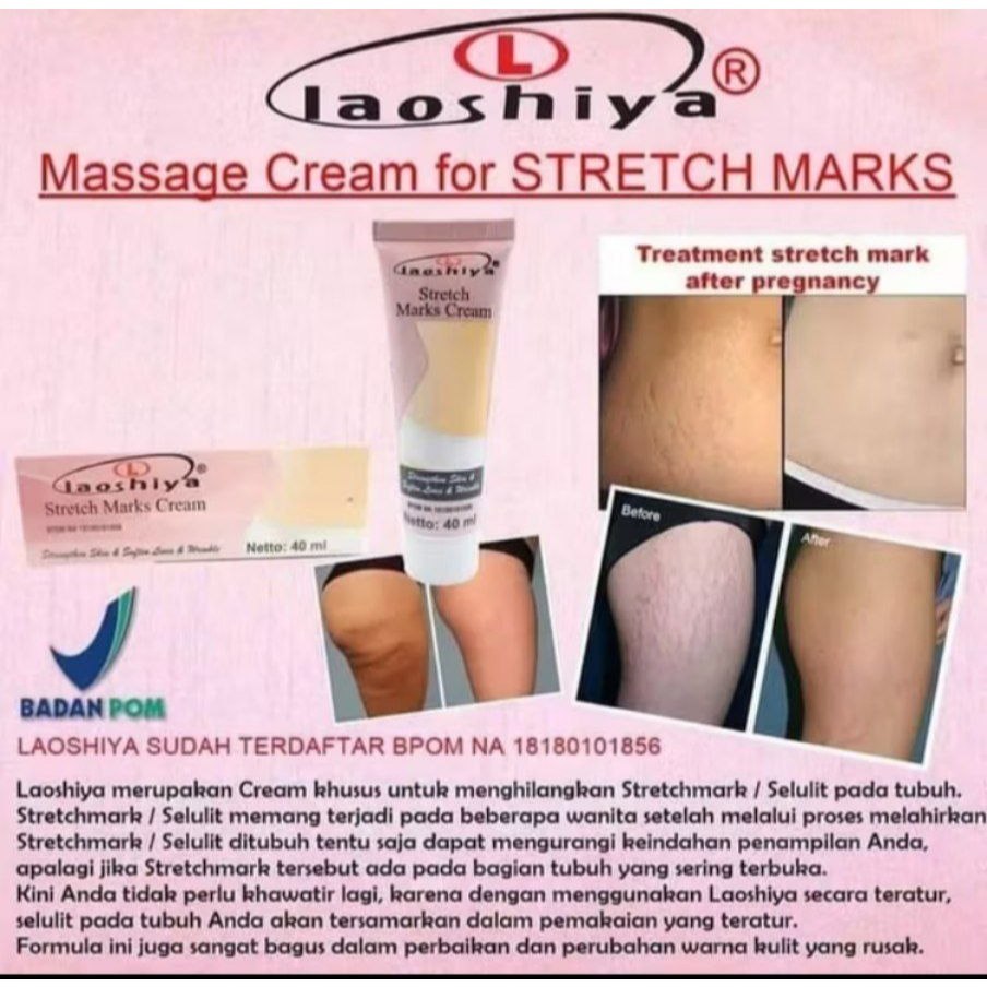 Krim Stretch Mark Herbal Penghilang stretch mark efektif menghilang stretch mark 120g penghilang str