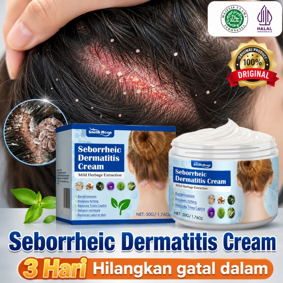 South Moon Seborrheic Dermatitis Cream 50g - Krim Dermatitis Seboroik Obat Dermatitis Seboroik, Obat
