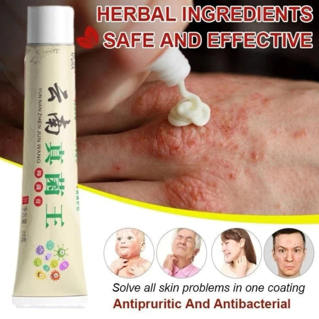 Salep Gatal Apdmp Kulit Ampuh Salep Cina Gatel Exim Kulit Salep Psoriasis Eksim Obat Gatal