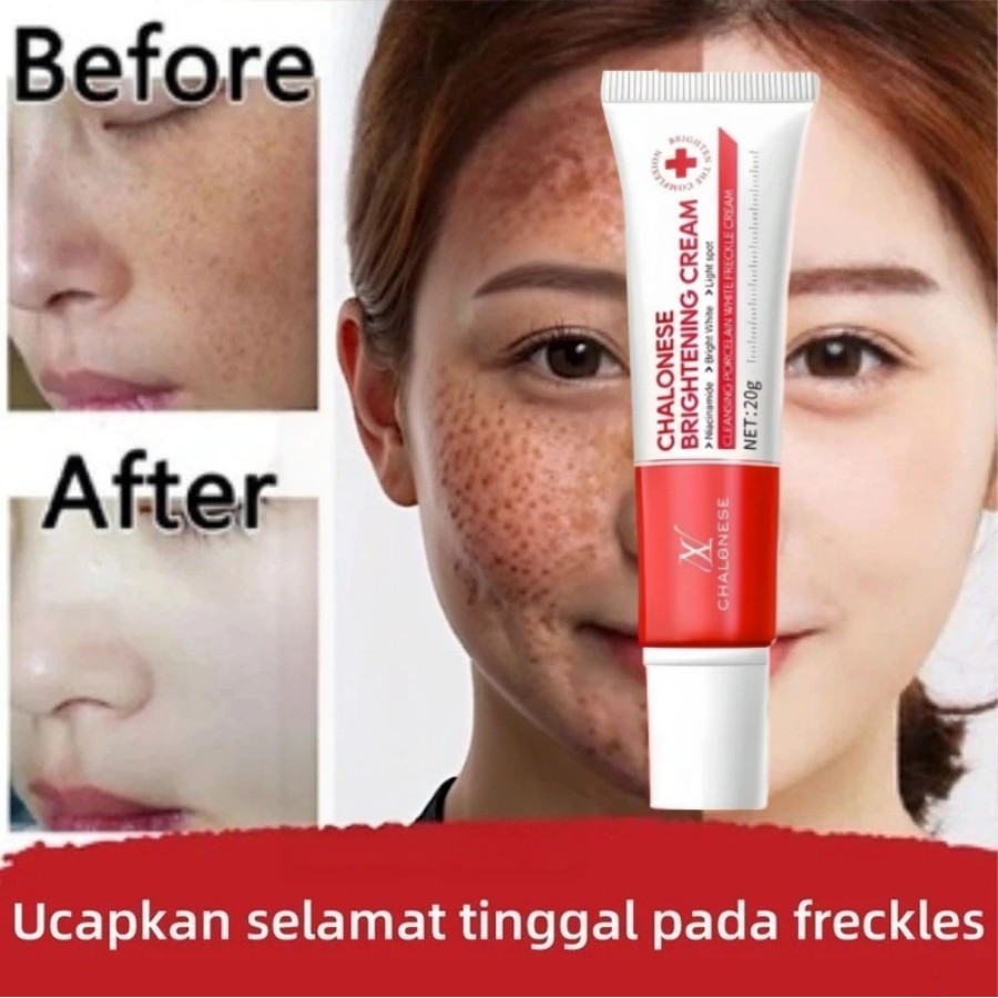 Salep Flek Hitam Membandel Krim Penghilang Flek Hitam BPOM Cream Whitening Penghilang Flek Dan Binti