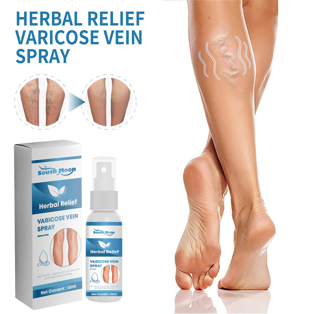 South Moon Varicose Veins Spray 30ml Obat Varises Salep Penghilang Varises Di Kaki Varises Semprot