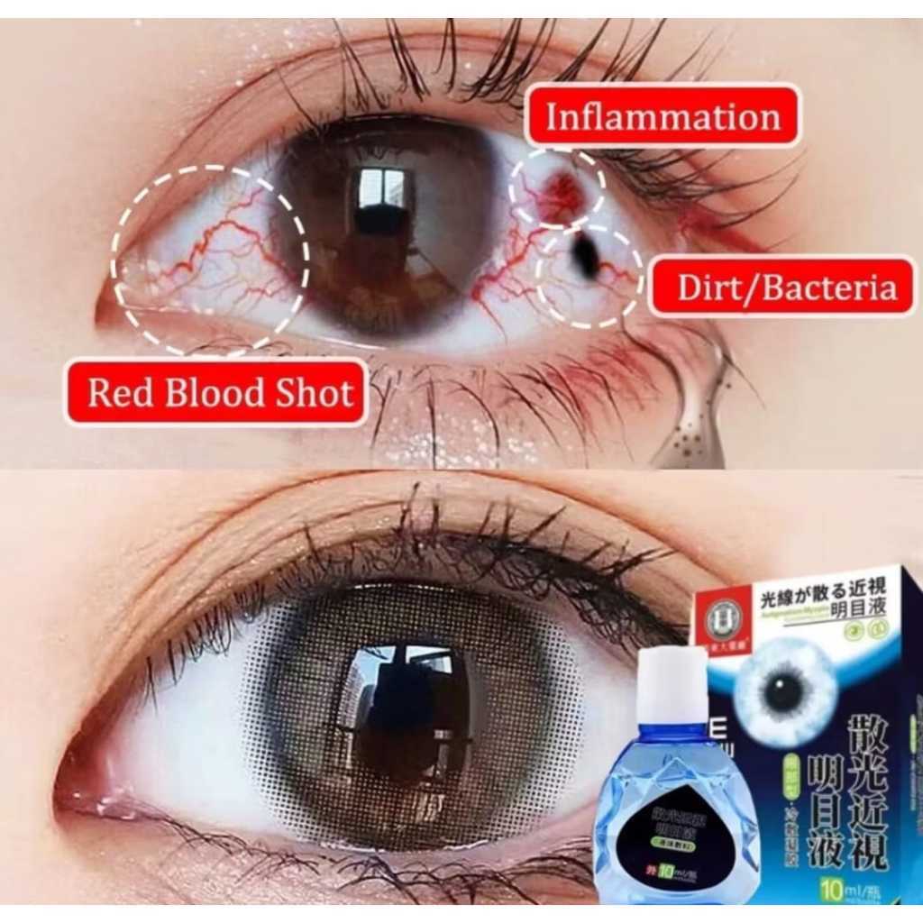 Obat Tetes Mata Obat Mata Katarak Eye Drop Tetes Mata Katarak Obat Sakit Mata Obat Mata Minus Mata K