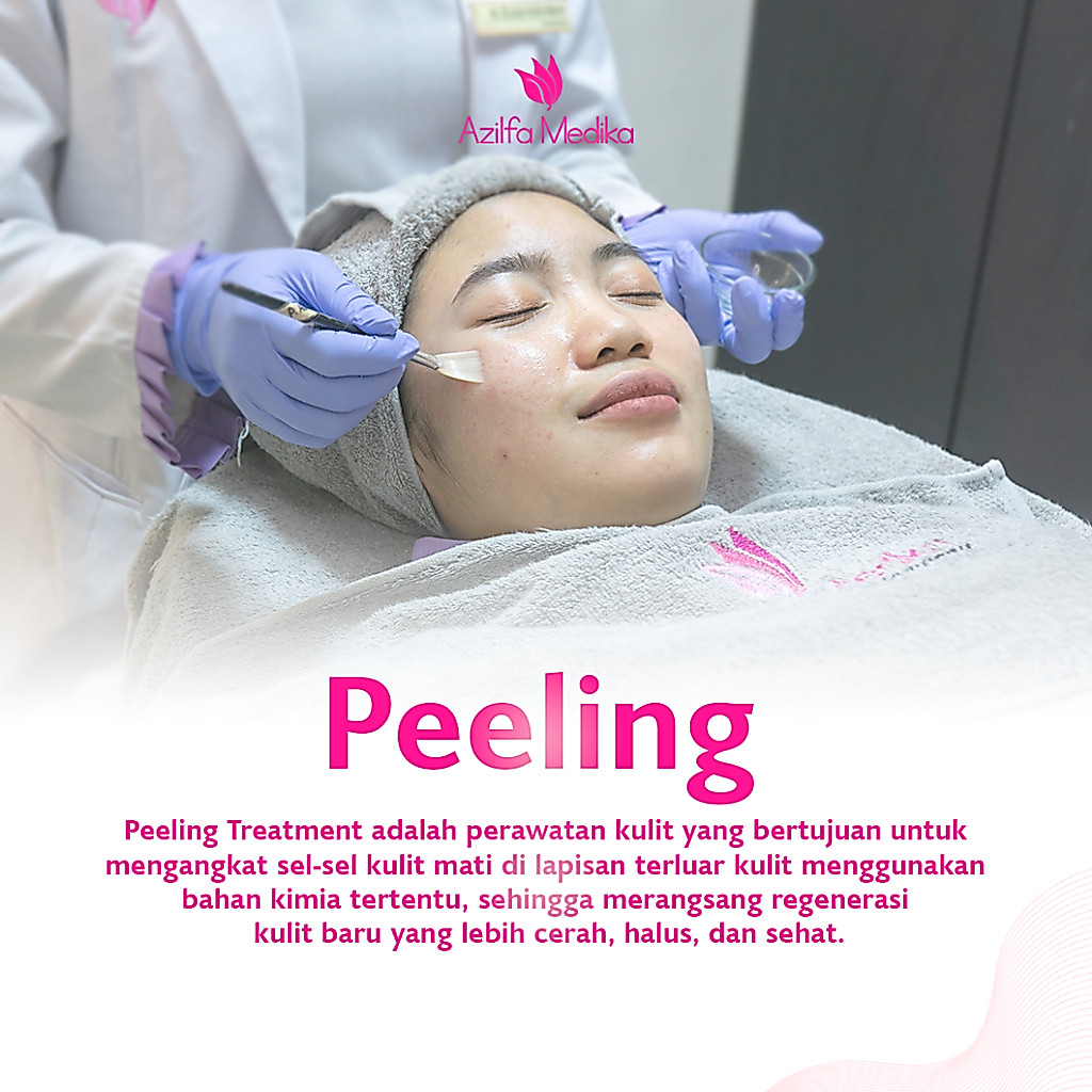 Peeling Voucher Treatment Azilfa Medika